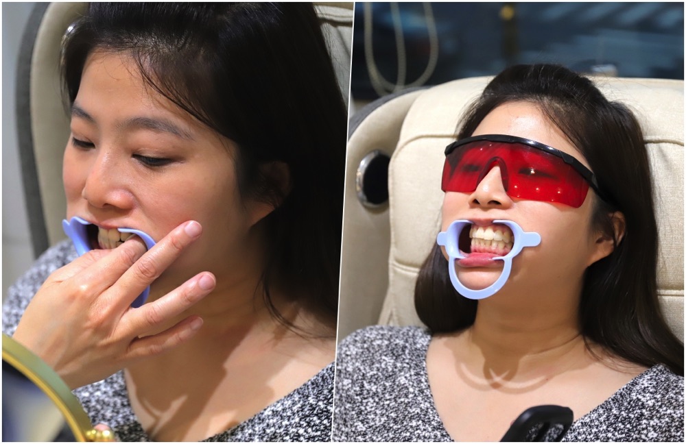 White lab淨白美學館：台南牙齒美白推薦/專業牙醫師指定保養流程/最新紅藍雙波長牙齒冷光淨白館/用30分鐘來睡一場牙齒美容覺，給你的美齒明亮透淨感